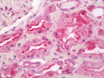 SCA2/LY6E Antibody