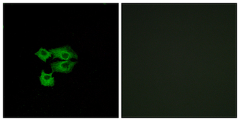 SCA2/LY6E Antibody