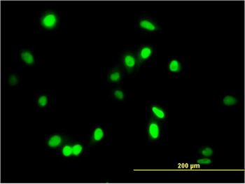 AATF Antibody