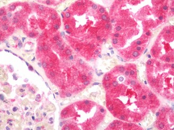 IQSEC1 Antibody