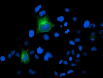 FOLH1/PSMA Antibody