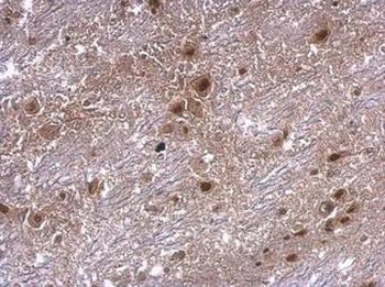 AXIN2/Axin 2 Antibody