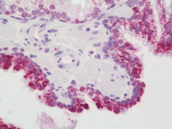 SMAD6 Antibody