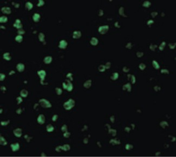 SARM1/SARM Antibody