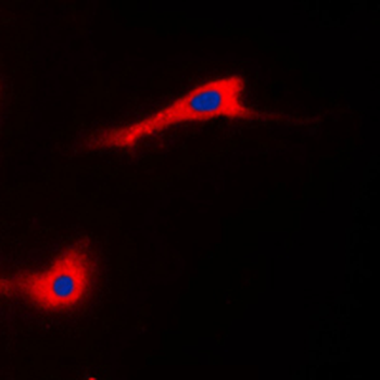 ADCK3/CABC1 Antibody