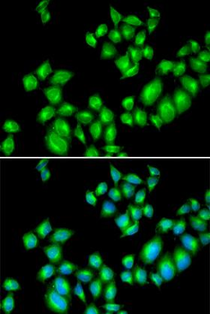 DRD3/Dopamine Receptor D3 Antibody