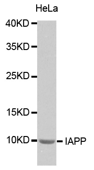 IAPP/Amylin Antibody
