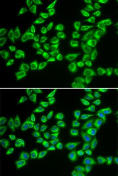 HADHB Antibody