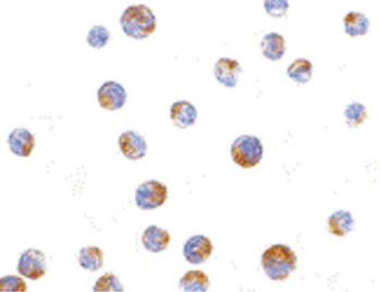 TIMD4/TIM4/TIM-4 Antibody