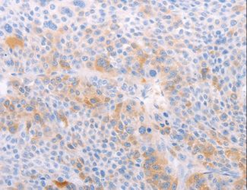 S1PR4/SIP4/EDG6 Antibody
