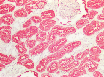 ANPEP/CD13 Antibody