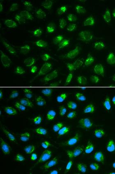 IL7 Antibody