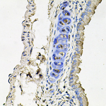 SLC39A4/ZIP4 Antibody
