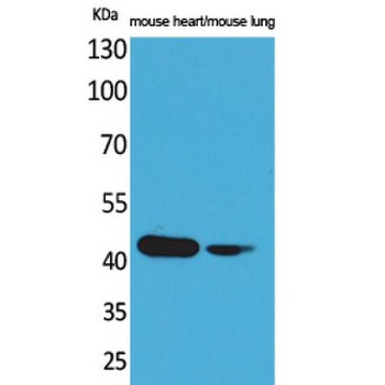ACTC1/Alpha Cardiac Actin Antibody