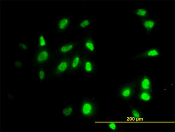 RAD18 Antibody