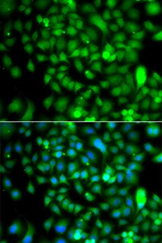 CSRP2BP Antibody