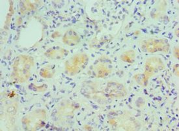 IL9 Antibody