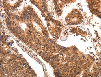 CCL17/TARC Antibody