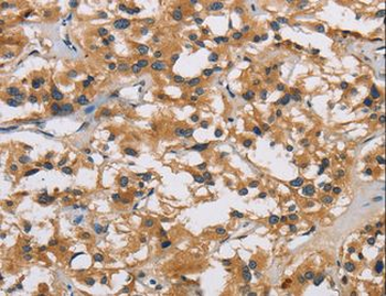 IL19 Antibody