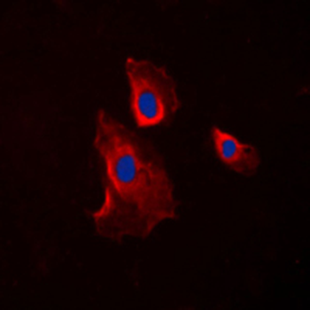 HRH2/Histamine H2 Receptor Antibody