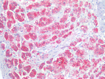 NCAM/CD56 Antibody