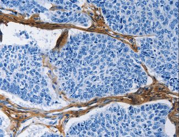 COL3A1/Collagen III Antibody