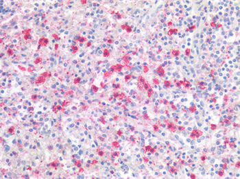 LAG3 Antibody