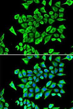 LCN2/Lipocalin 2/NGAL Antibody