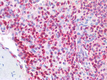 LSP1 Antibody