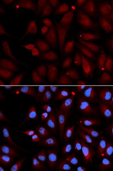 MAOB/Monoamine Oxidase B Antibody