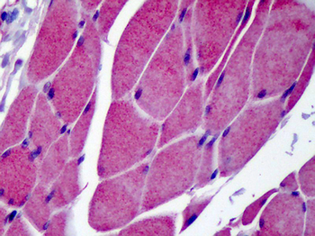 TRPC3 Antibody