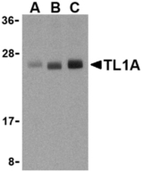 TNFSF15/TL1A/VEGI Antibody
