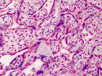 GDF15 Antibody
