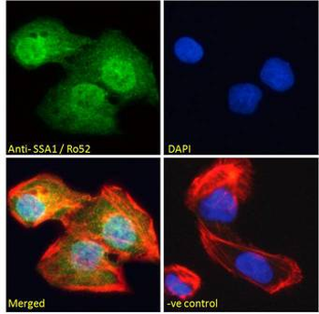 TRIM21/RO52 Antibody