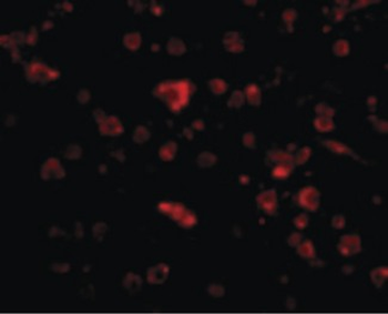 MANF/ARMET Antibody