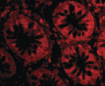 TEM1/CD248 Antibody