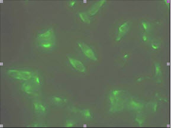 STEAP1/STEAP Antibody