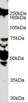ROBO1 Antibody