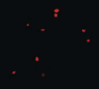 CIDEB Antibody