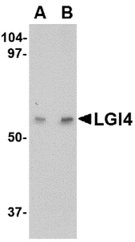 LGI4 Antibody