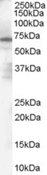 PARP2 Antibody