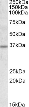 UCP2 Antibody
