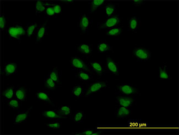 MBNL1/MBNL Antibody