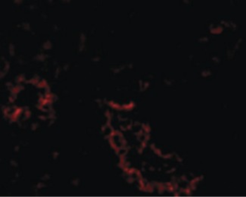 ACE2/ACE-2 Antibody