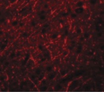 PRDM16 Antibody