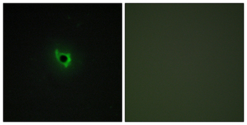 EPHA6/EPH Receptor A6 Antibody