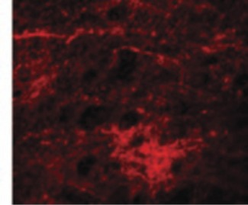 SIPA1L3 Antibody