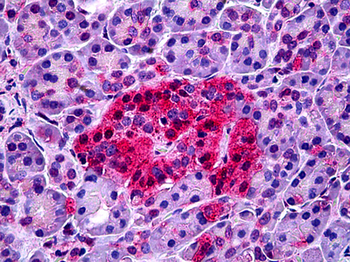 NTSR1/NTR Antibody