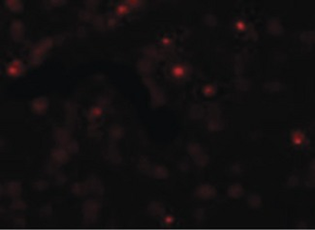 SCUBE2 Antibody