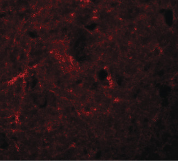 NLRP7/NALP7 Antibody